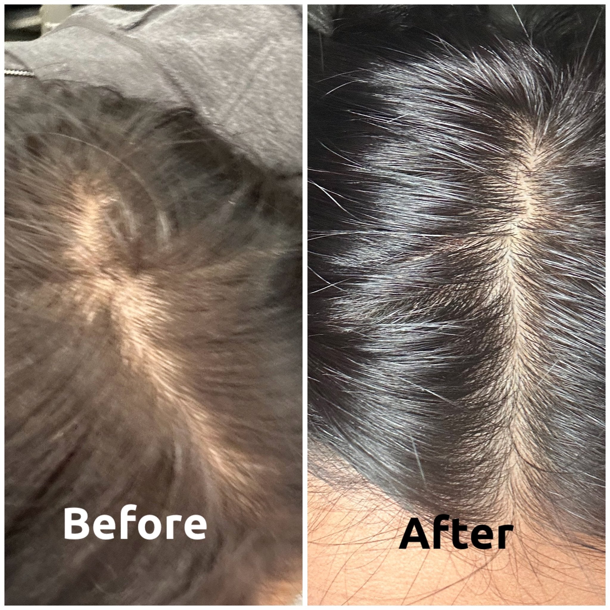 Keśa Hair Growth Oil | Natural Organic Serum for Alopecia Hair Loss with DHT Blockers - keśa beauty